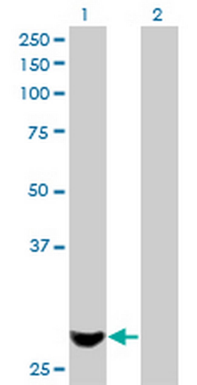 PMM2 Antibody in Western Blot (WB)