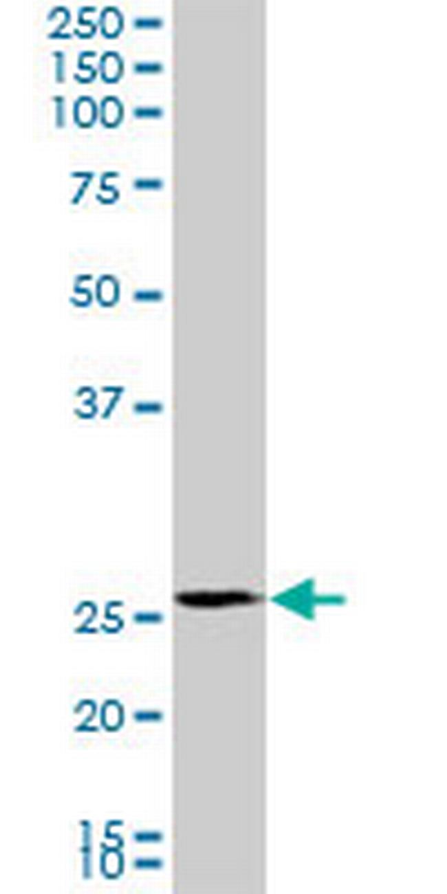 PMM2 Antibody in Western Blot (WB)