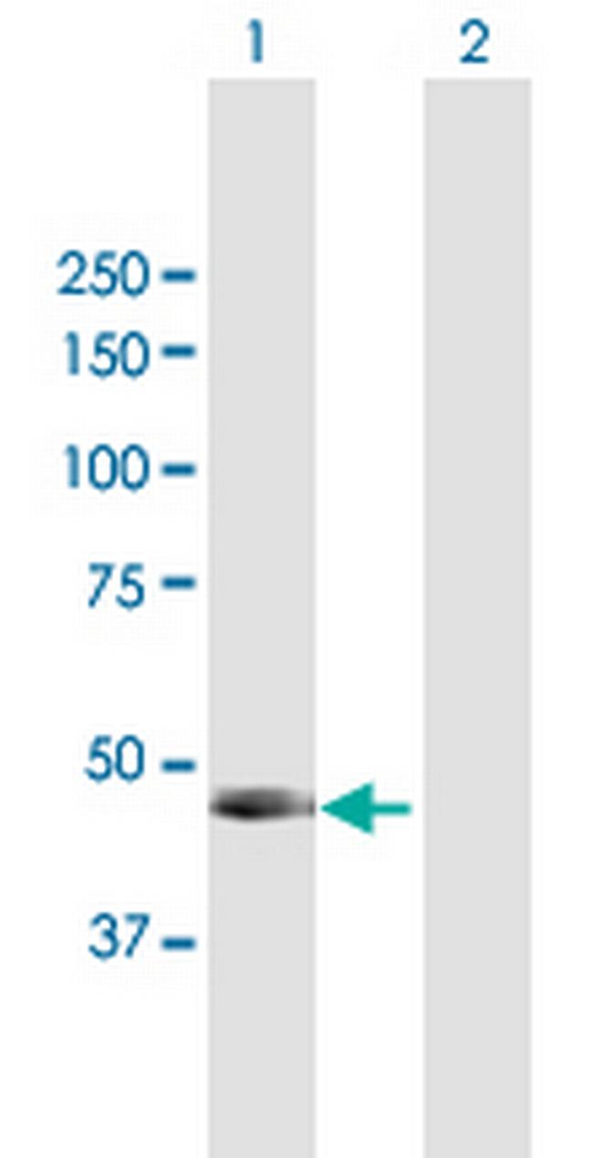 PNLIP Antibody in Western Blot (WB)