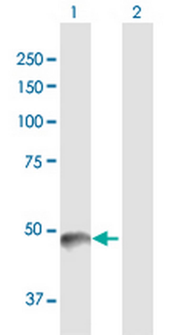 PNLIP Antibody in Western Blot (WB)