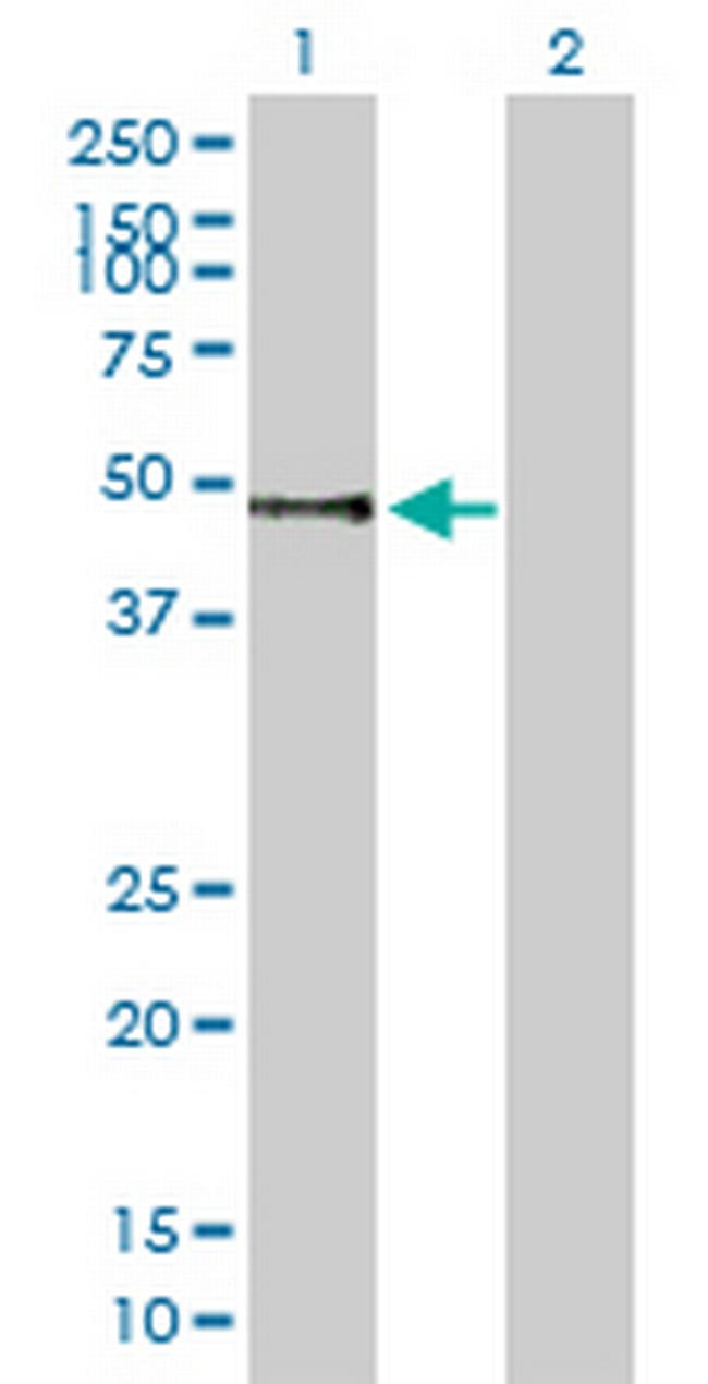 PNLIPRP1 Antibody in Western Blot (WB)