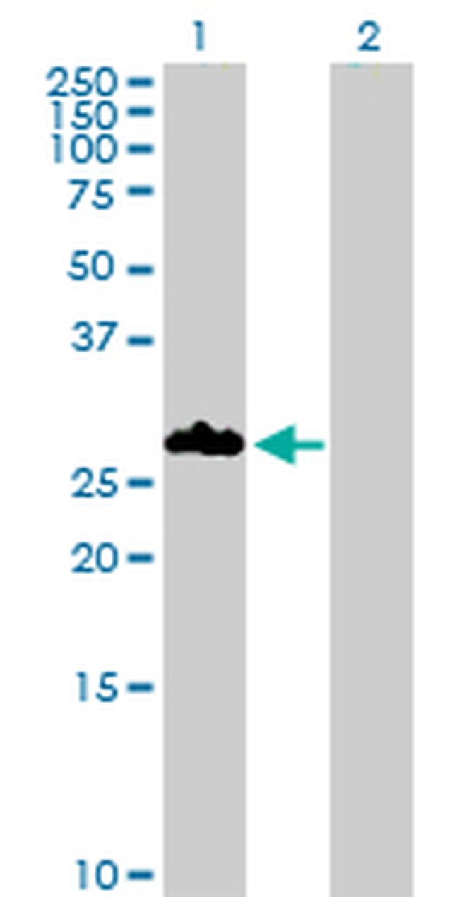 PNMT Antibody in Western Blot (WB)