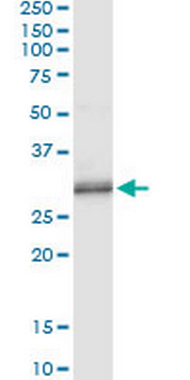 PNMT Antibody in Immunoprecipitation (IP)