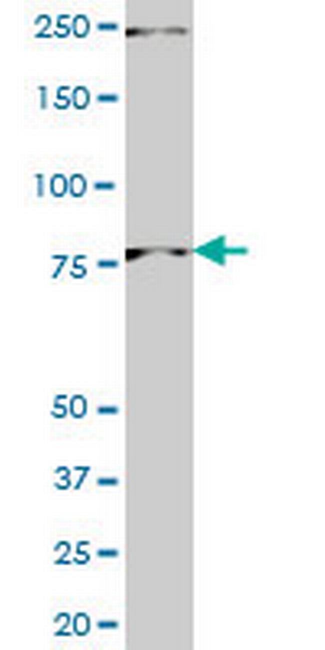 PNN Antibody in Western Blot (WB)