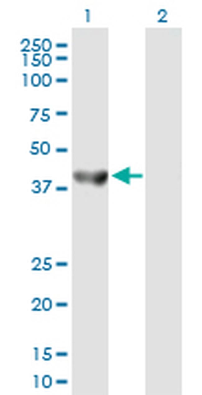 SEPT5 Antibody in Western Blot (WB)