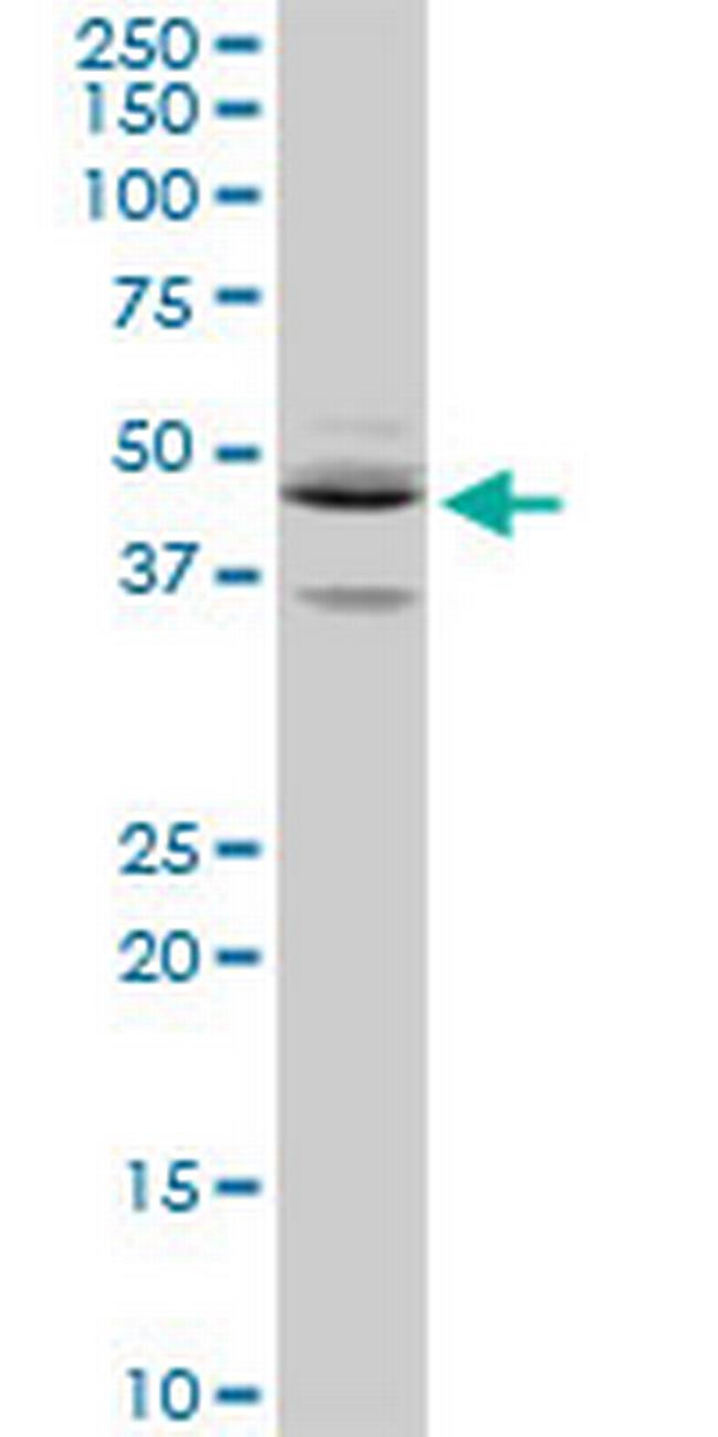 SEPT5 Antibody in Western Blot (WB)