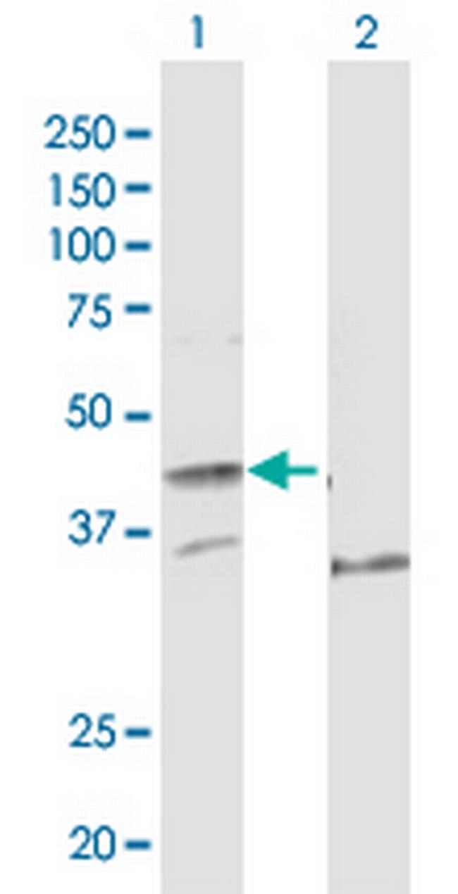 POLE Antibody in Western Blot (WB)