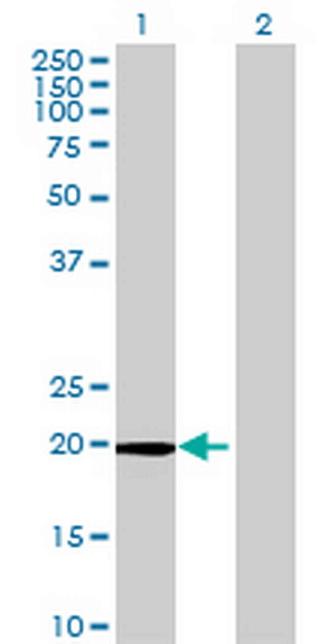 POLR2G Antibody in Western Blot (WB)