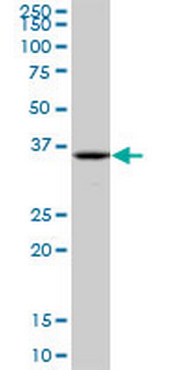 POMC Antibody in Western Blot (WB)