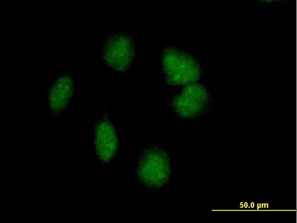 POMC Antibody in Immunocytochemistry (ICC/IF)