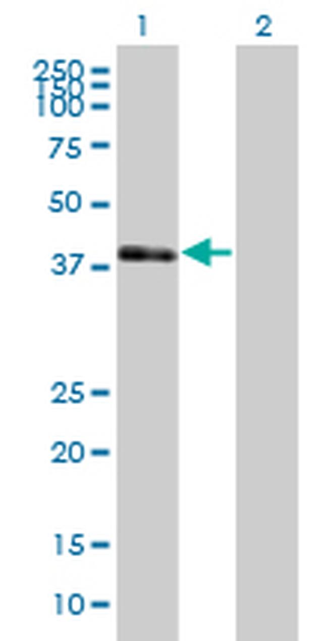 POU3F4 Antibody in Western Blot (WB)