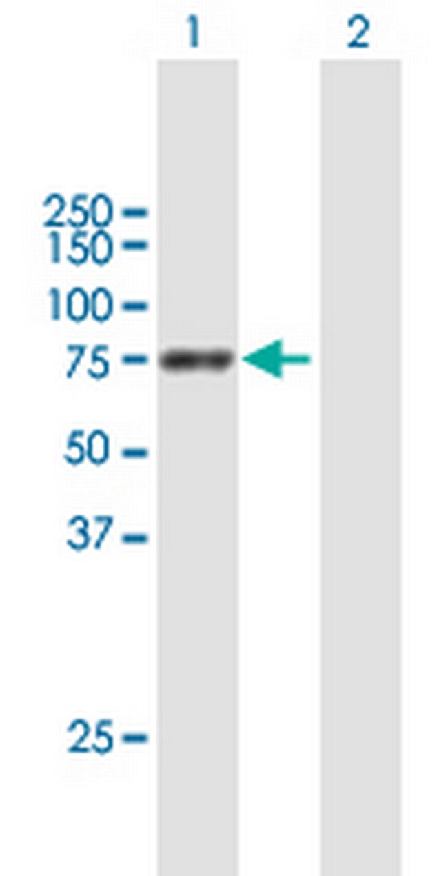 PPEF1 Antibody in Western Blot (WB)