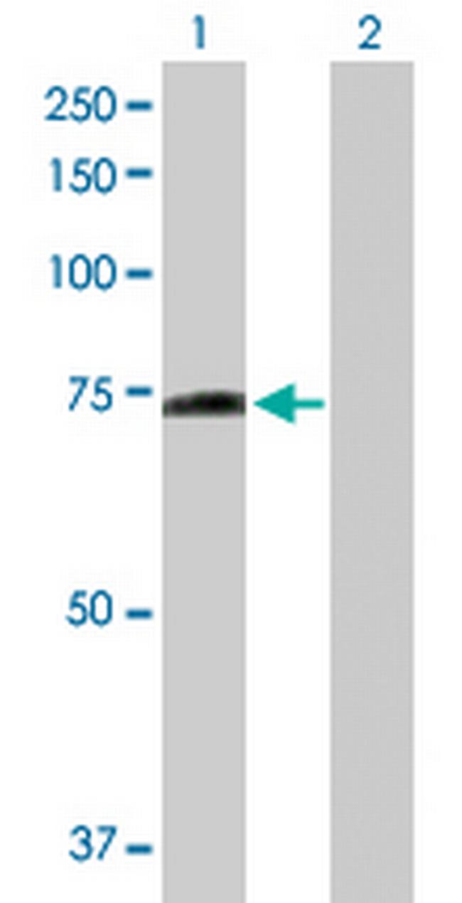 PPEF1 Antibody in Western Blot (WB)