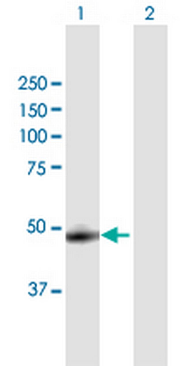 CTSA Antibody in Western Blot (WB)