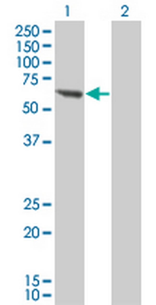 PPM1B Antibody in Western Blot (WB)