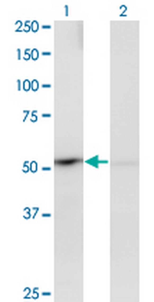 PPOX Antibody in Western Blot (WB)
