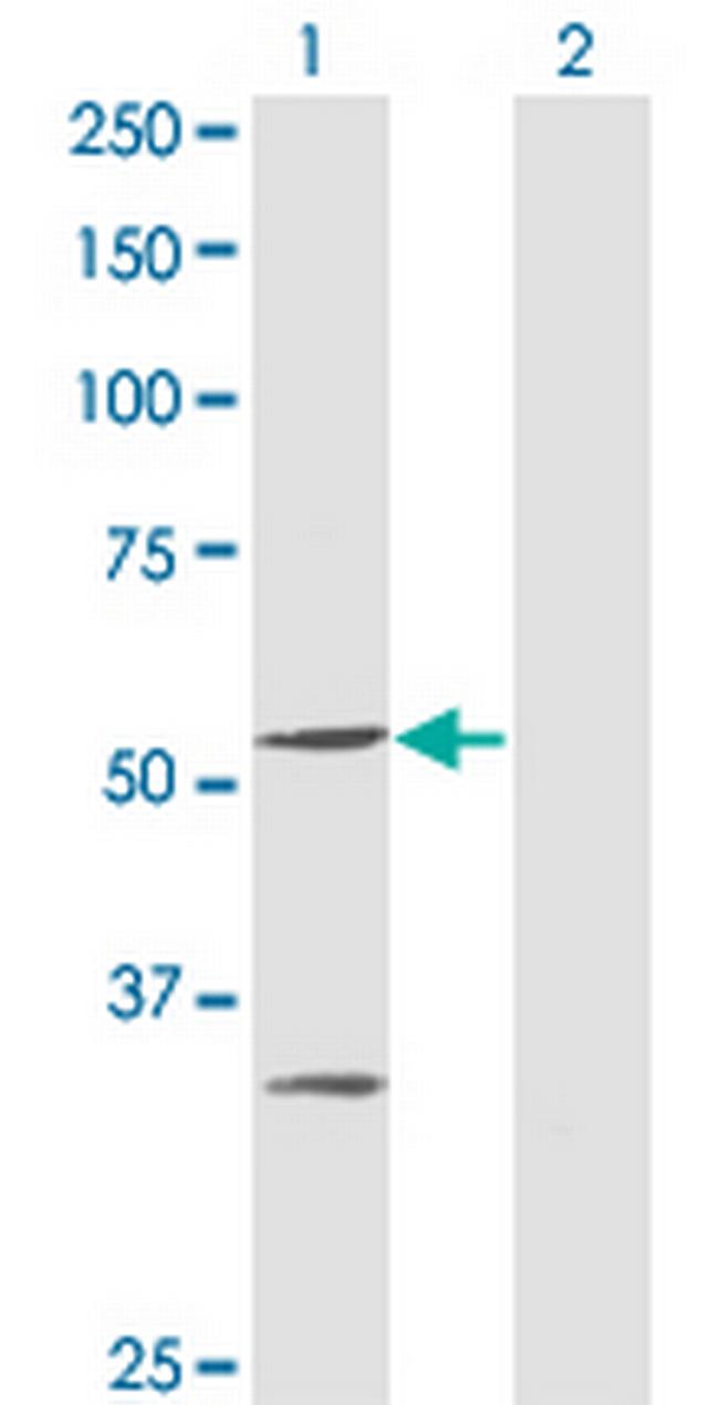 PPOX Antibody in Western Blot (WB)