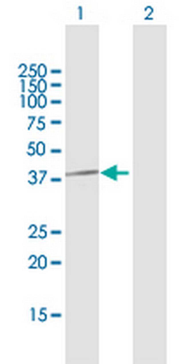 PPP1CC Antibody in Western Blot (WB)