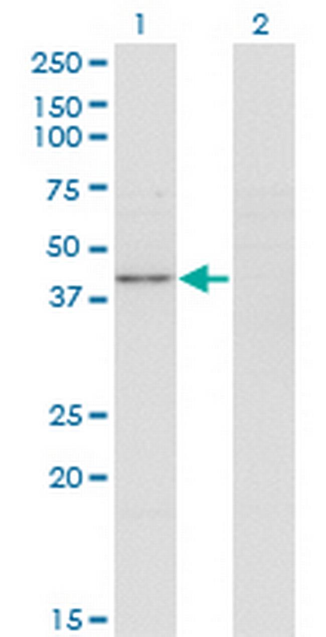 PPP1R8 Antibody in Western Blot (WB)
