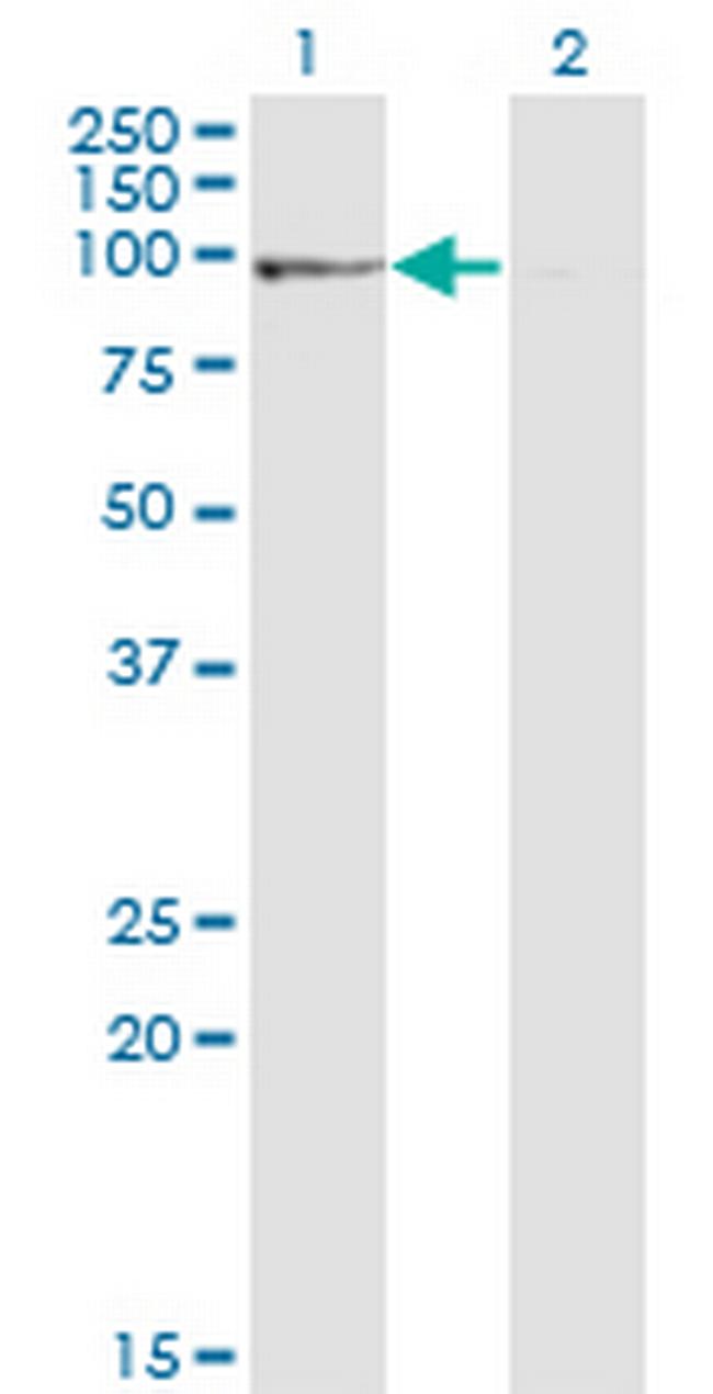 PPP1R10 Antibody in Western Blot (WB)