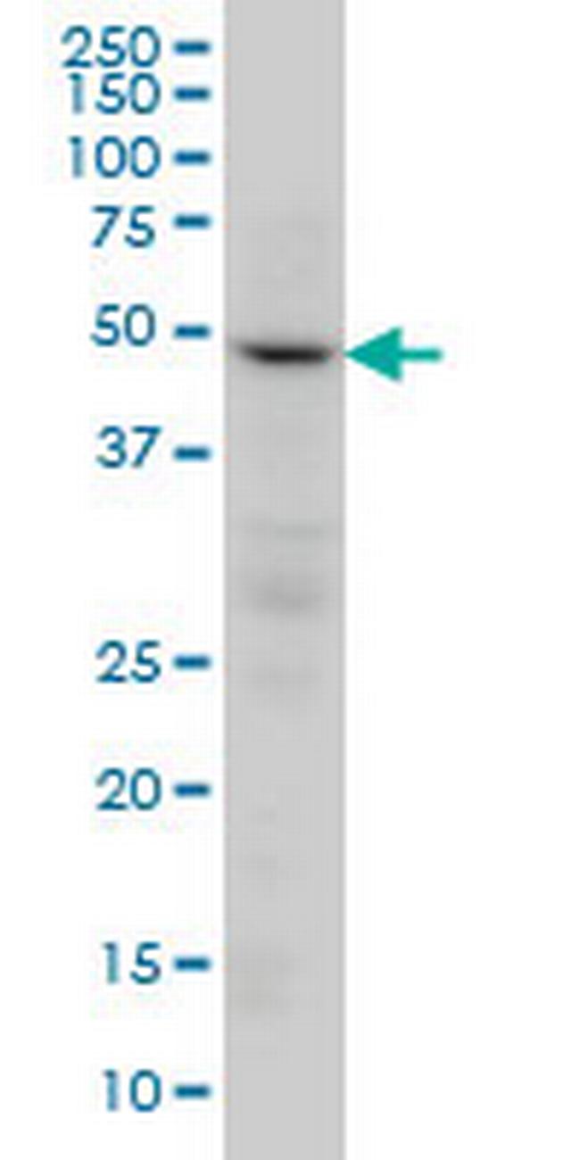 PPP2R2C Antibody in Western Blot (WB)