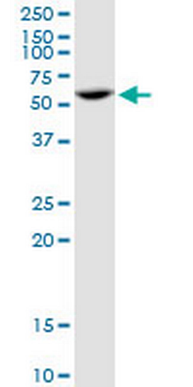 PPP2R5A Antibody in Western Blot (WB)