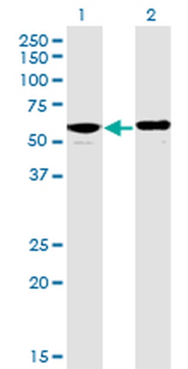 PPP2R5D Antibody in Western Blot (WB)