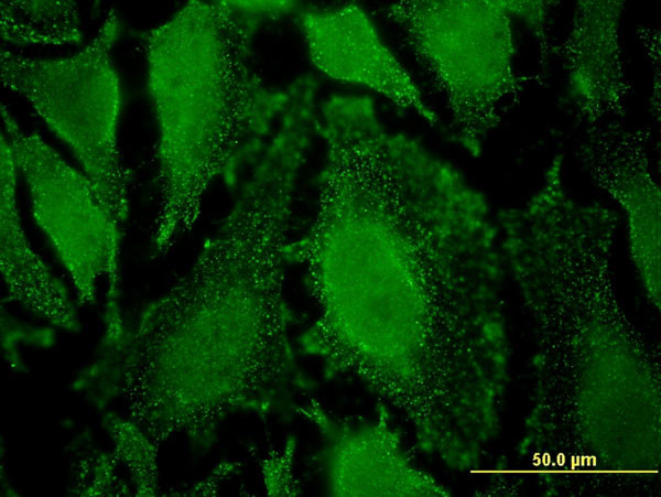 PPP2R5D Antibody in Immunocytochemistry (ICC/IF)