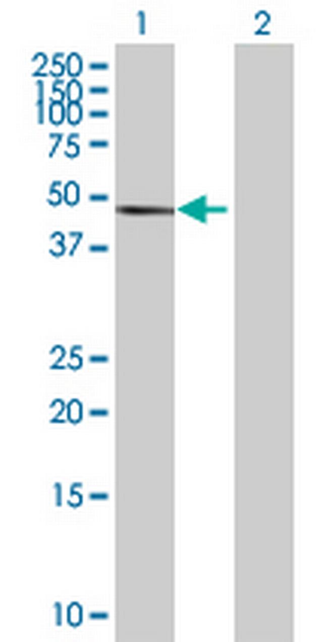PPP2R5E Antibody in Western Blot (WB)