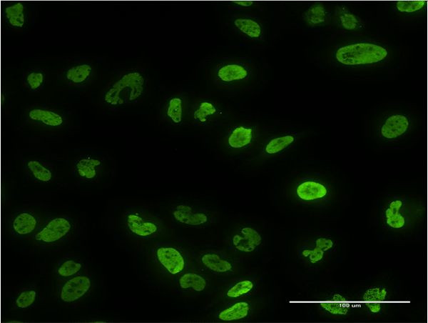 PPP3CA Antibody in Immunocytochemistry (ICC/IF)