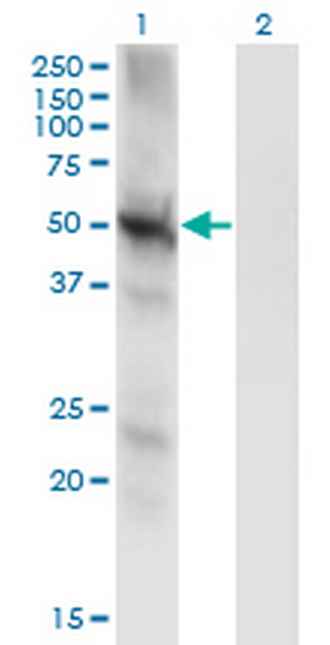 PPP3CC Antibody in Western Blot (WB)