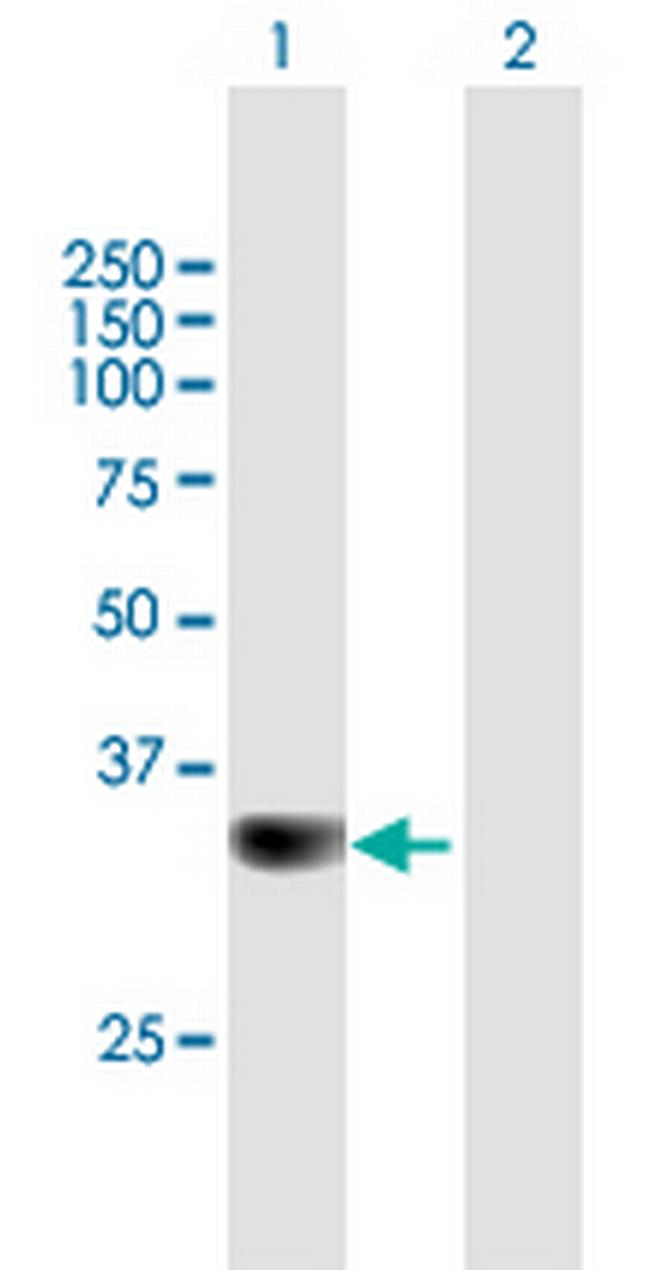 PPP6C Antibody in Western Blot (WB)