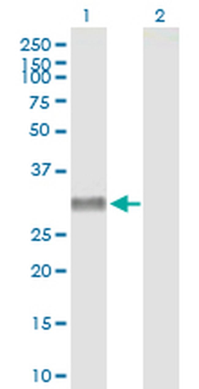 PPYR1 Antibody in Western Blot (WB)