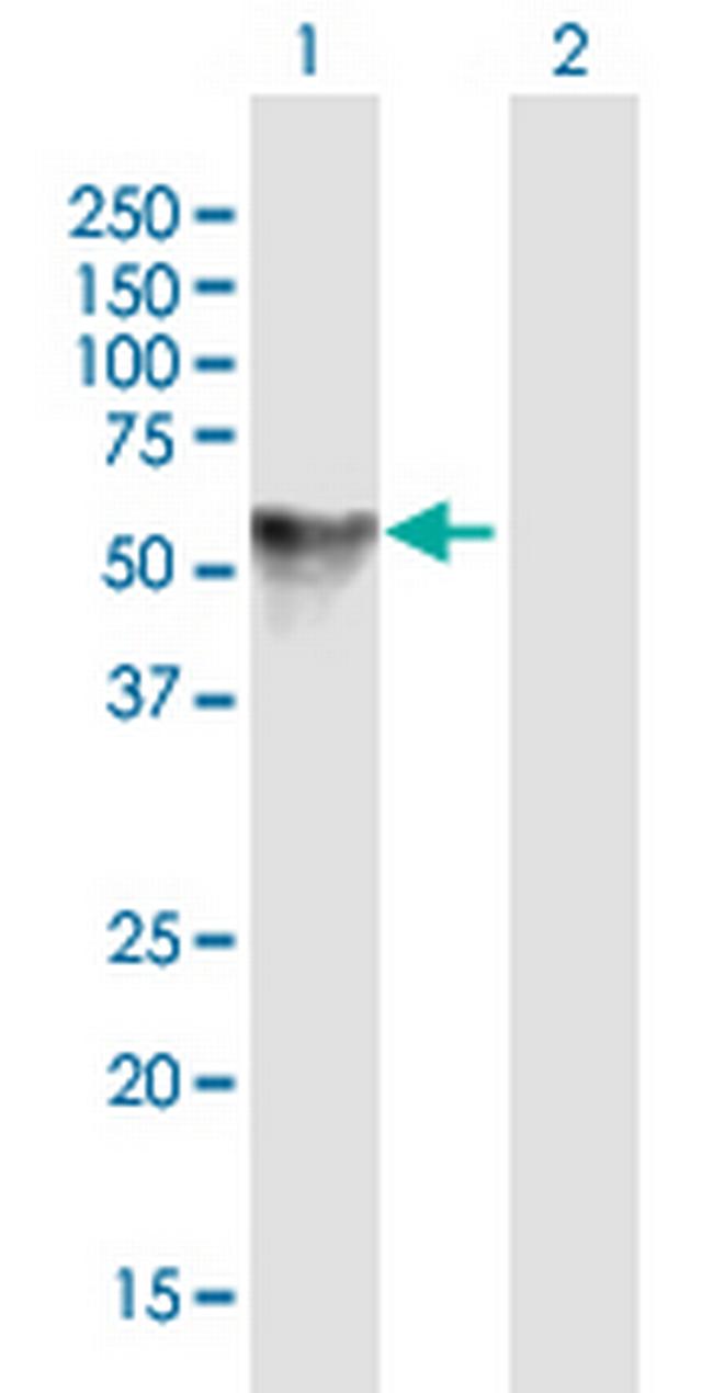PRCP Antibody in Western Blot (WB)