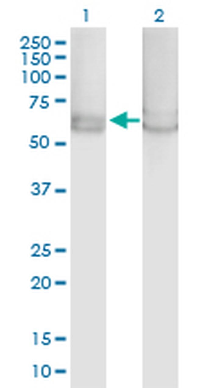 PRKAA1 Antibody in Western Blot (WB)