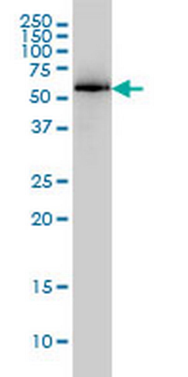 PRKAA1 Antibody in Western Blot (WB)