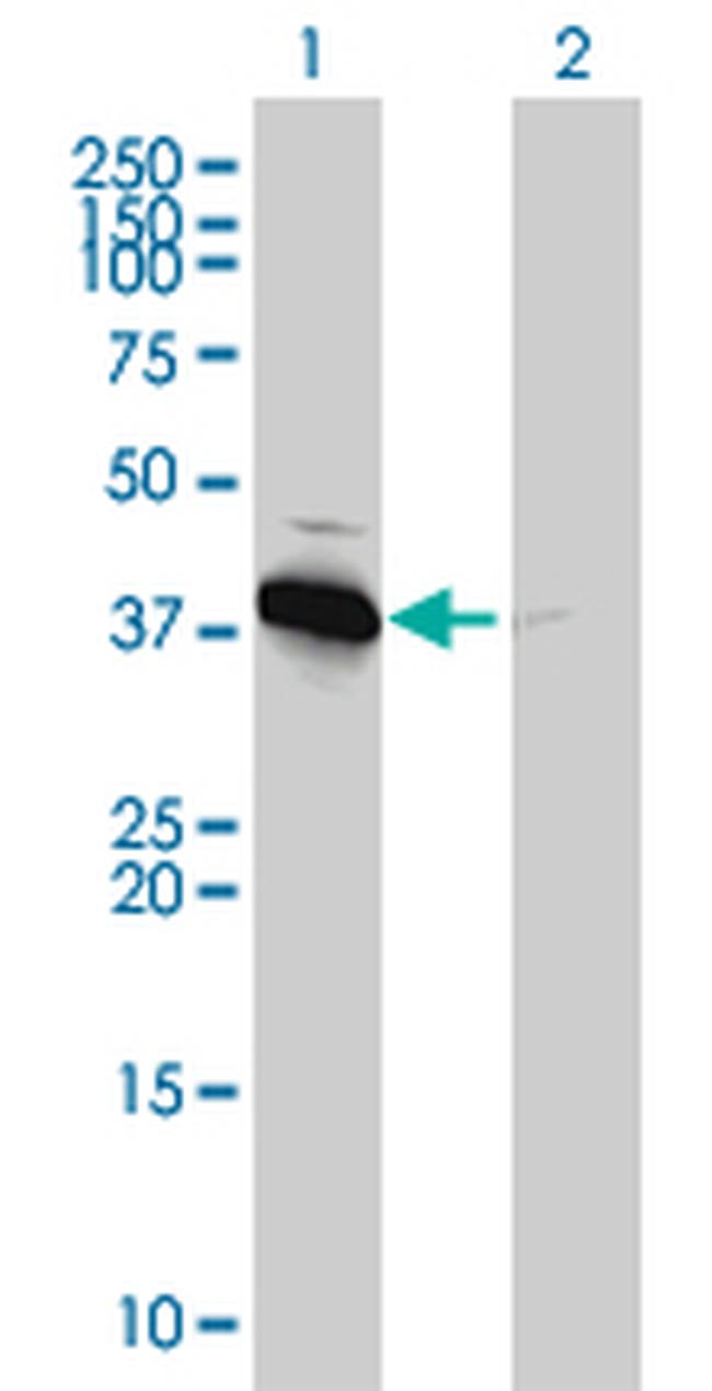 PRKAB1 Antibody in Western Blot (WB)