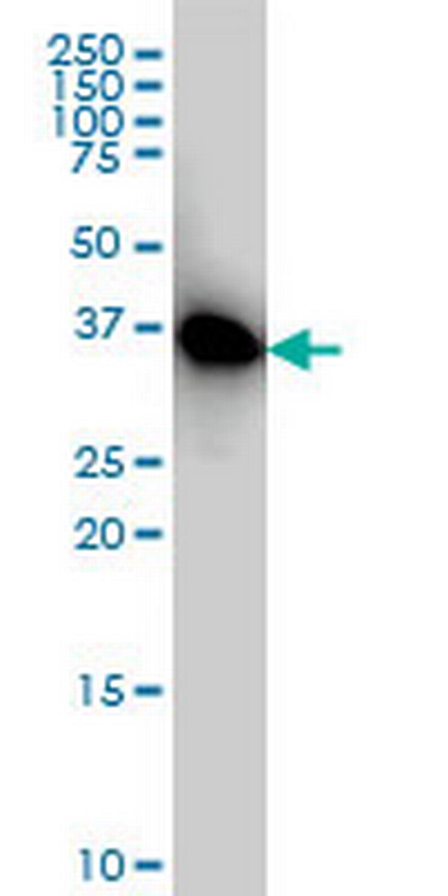 PRKAB1 Antibody in Western Blot (WB)