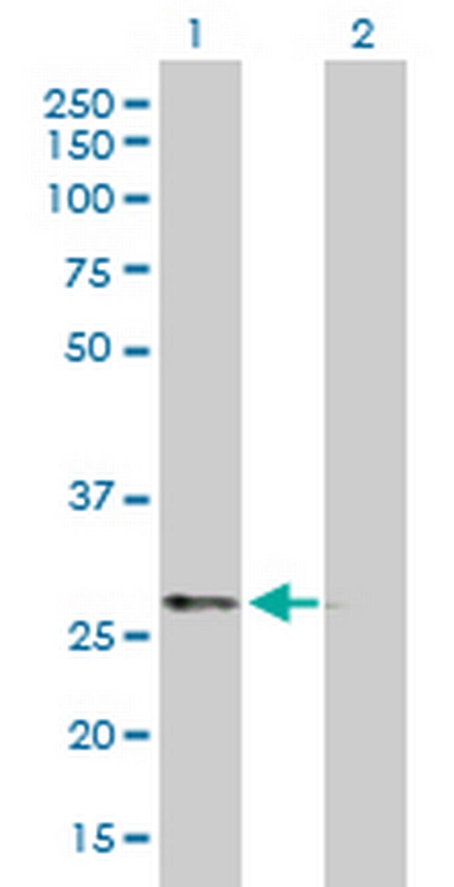 PRKAB2 Antibody in Western Blot (WB)