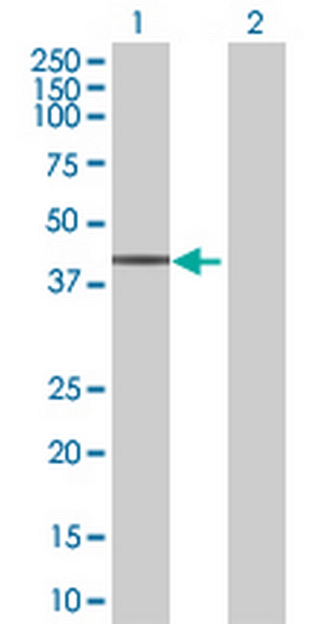 PRKACG Antibody in Western Blot (WB)