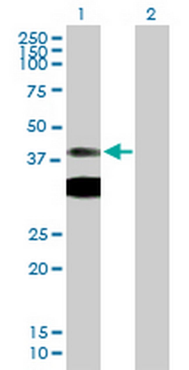 PRKAR1A Antibody in Western Blot (WB)
