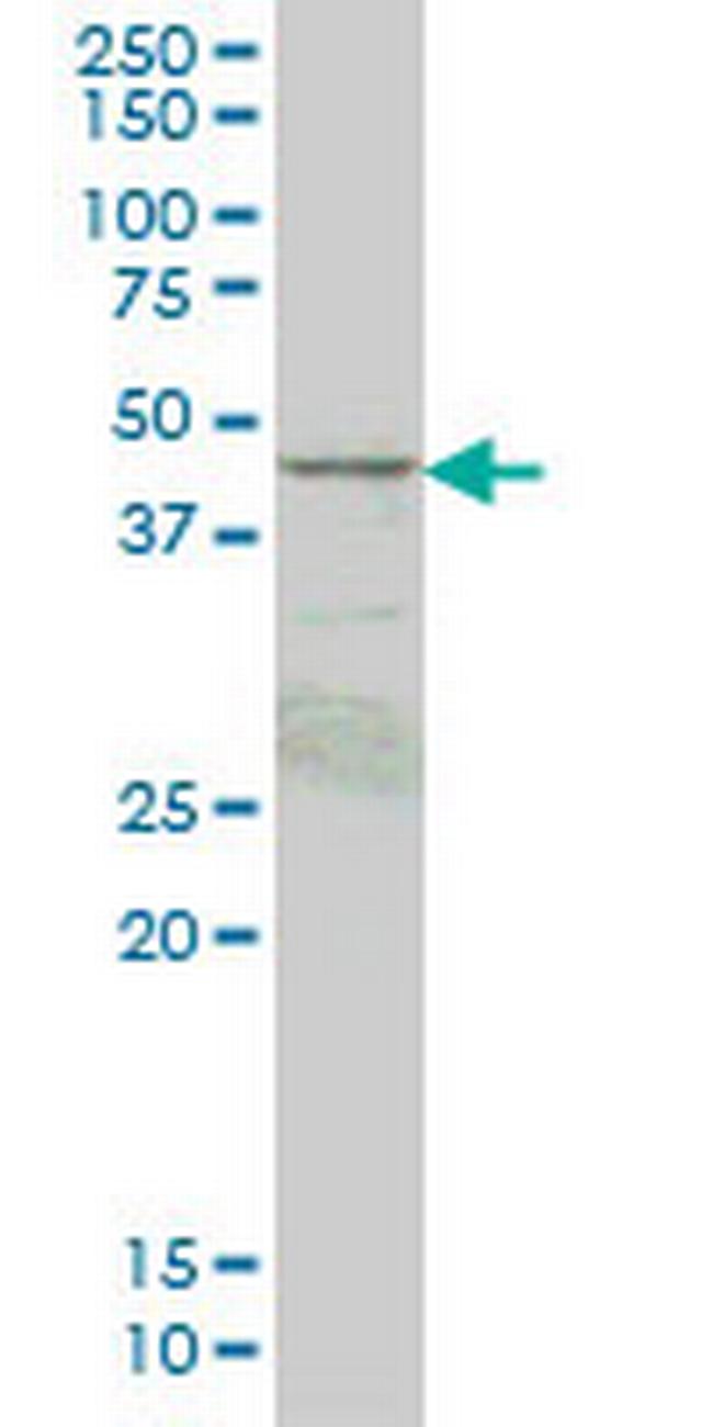 PRKAR1B Antibody in Western Blot (WB)