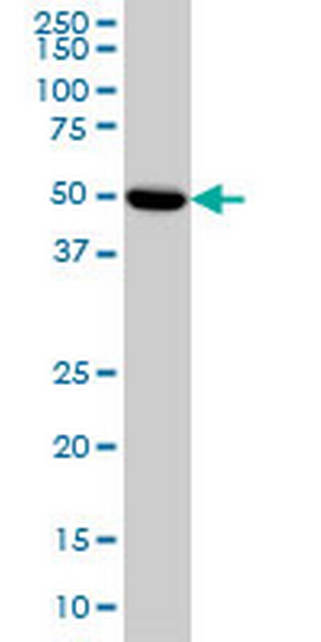 PRKAR2A Antibody in Western Blot (WB)