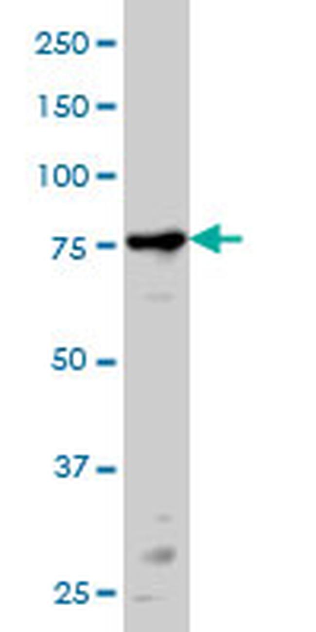 PRKCA Antibody in Western Blot (WB)