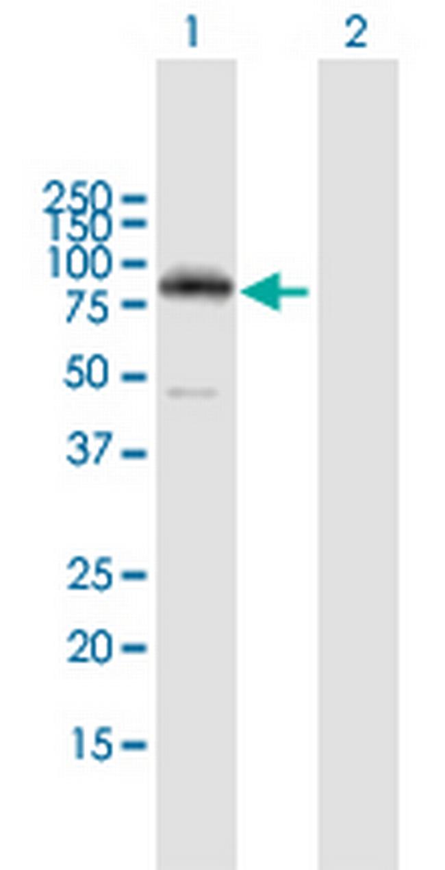 PRKCH Antibody in Western Blot (WB)