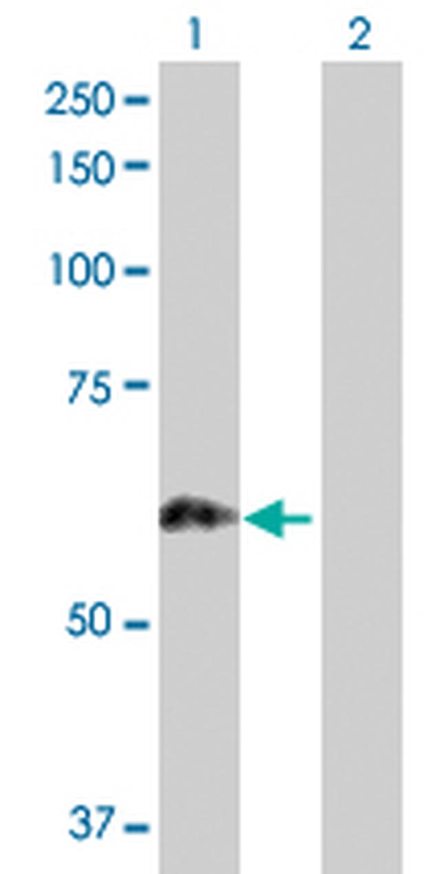 PRKCSH Antibody in Western Blot (WB)