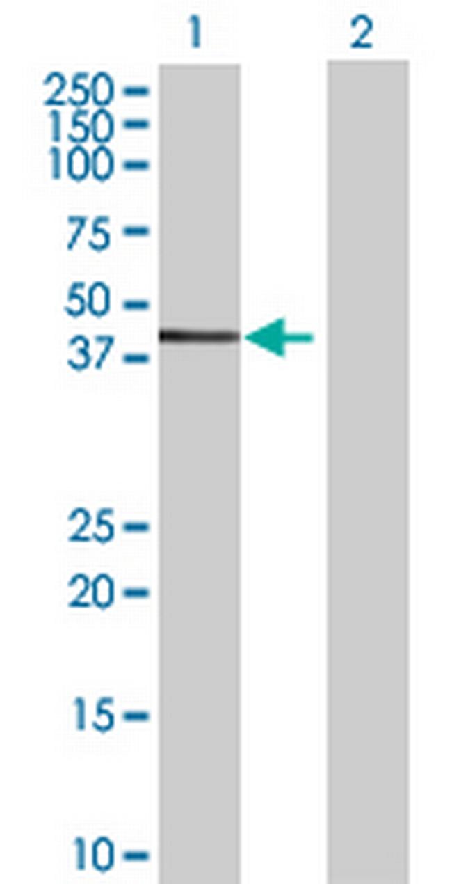 PRKG1 Antibody in Western Blot (WB)