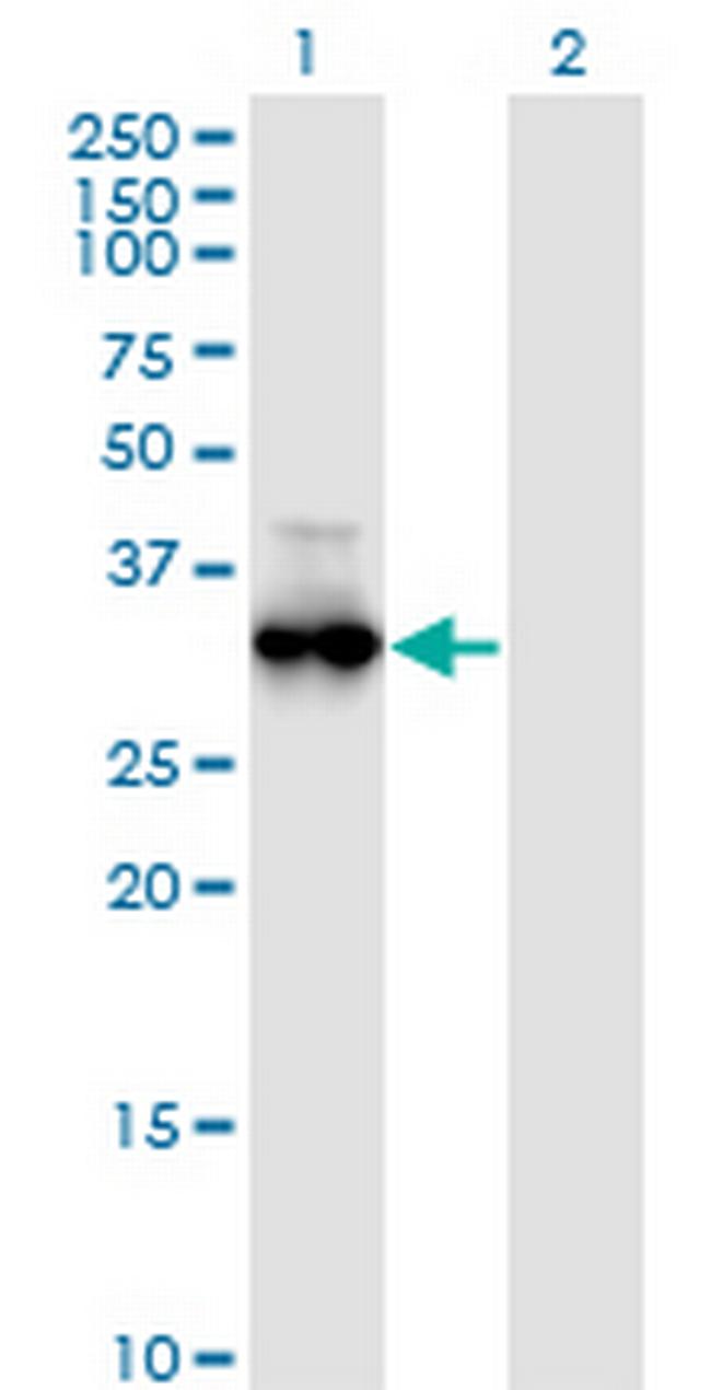 PRKG1 Antibody in Western Blot (WB)