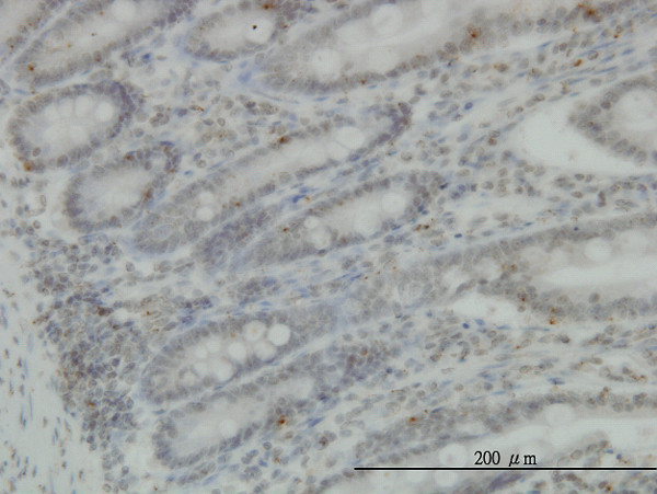 PRKG1 Antibody in Immunohistochemistry (Paraffin) (IHC (P))