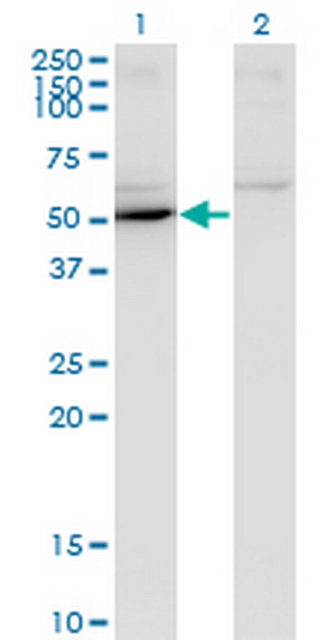MAPK8 Antibody in Western Blot (WB)